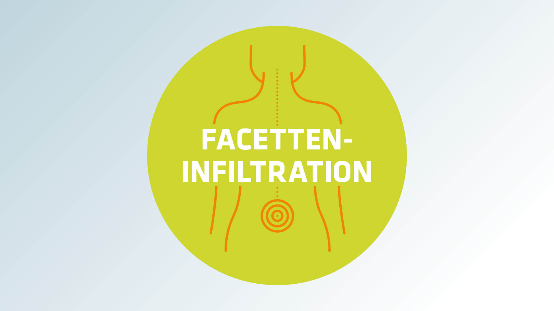 Facetteninfiltration